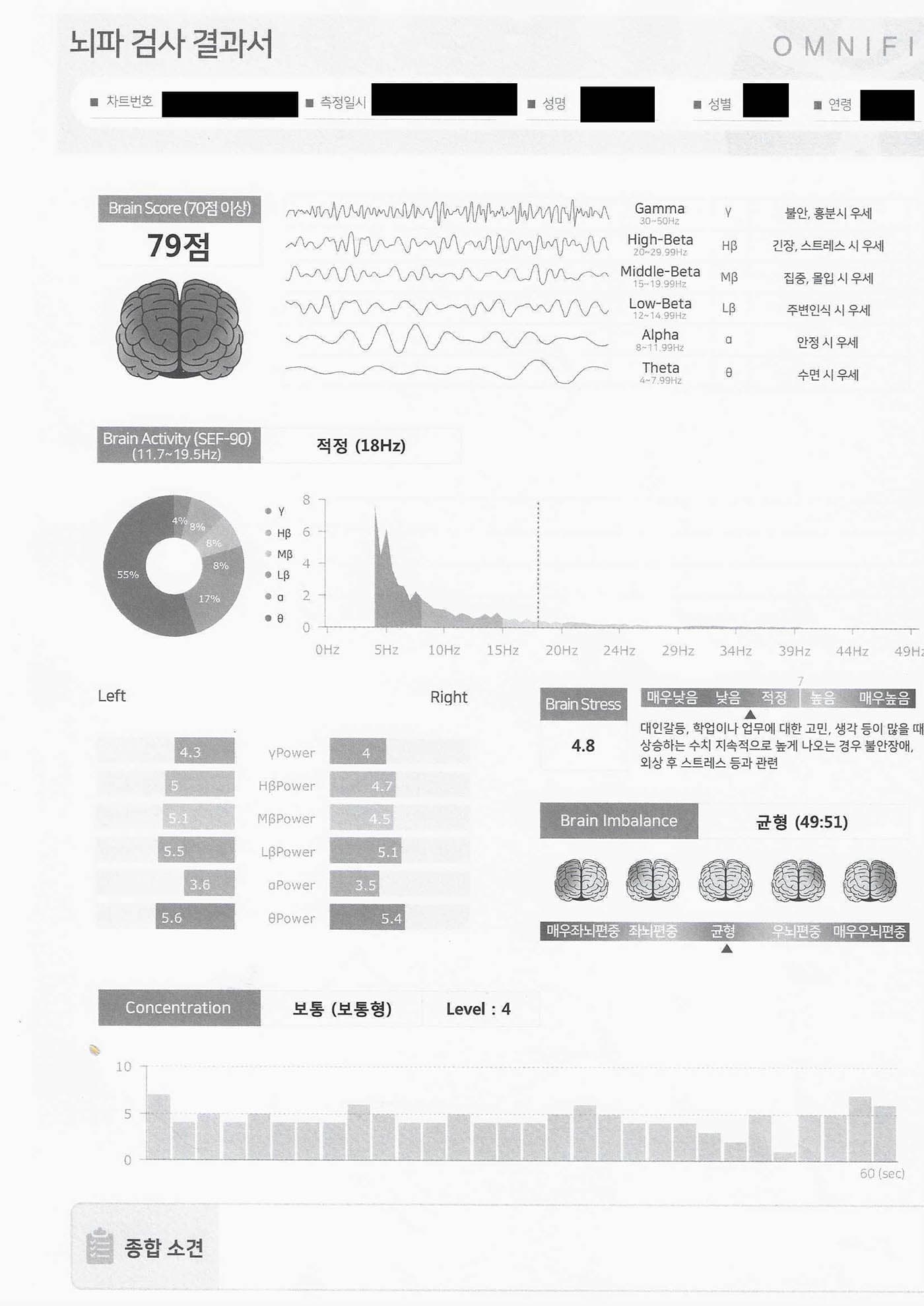 뇌파결과